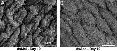 Deficiency of Acetyl-CoA Carboxylase Impairs Digestion, Lipid Synthesis, and Reproduction in the Kissing Bug Rhodnius prolixus